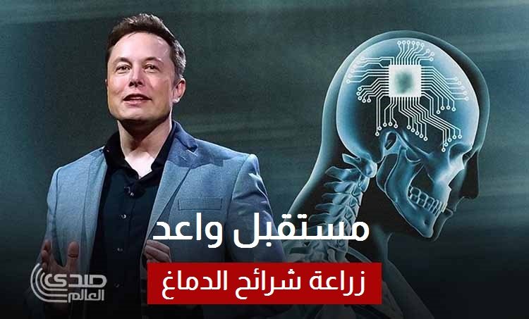 إيلون ماسك يراهن على مستقبل واعد لتقنية زراعة شرائح الدماغ