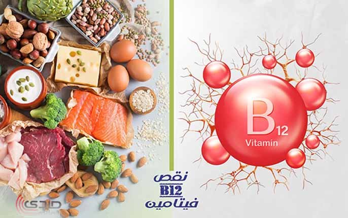 نقص فيتامين ب 12.. اعراضه وتأثيره على صحتك